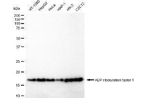 Western blotting analysis using ADP ribosylation factor 1 antibody (ABIN7797530). (Recombinant ARF1 抗体)