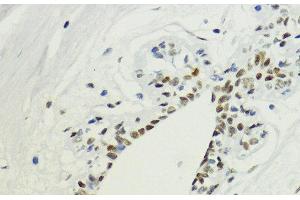 Immunohistochemistry of paraffin-embedded Human breast using DiMethyl-Histone H3-K36 Polyclonal Antibody at dilution of 1:200 (40x lens). (Histone 3 抗体  (2meLys36))