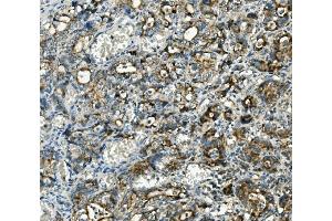 IHC analysis of Thioredoxin 2/TXN2 using anti-Thioredoxin 2/TXN2 antibody (ABIN7602148).