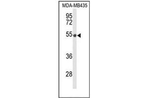 Western blot analysis of DMC1 Antibody (N-term) in MDA-MB435 cell line lysates (35ug/lane). (DMC1 抗体  (N-Term))