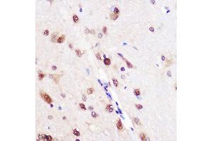 Immunohistochemistry of paraffin-embedded Rat brain using CELF1 Rabbit pAb (ABIN6131012, ABIN6138399, ABIN6138400 and ABIN6221641) at dilution of 1:100 (40x lens). (CELF1 抗体  (AA 108-483))