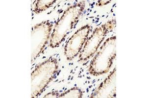 Immunohistochemical analysis of paraffin-embedded H. (CSE1L 抗体  (N-Term))