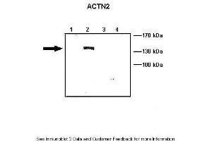 Lanes:   Lane1: 10 ug ACTN1-GFP transfected COS-7 lysate Lane2: 10 ug ACTN2-GFP transfected COS-7 lysate Lane3: 10 ug ACTN3-GFP transfected COS-7 lysate Lane4: 10 ug ACTN4-GFP transfected COS-7 lysate  Primary Antibody Dilution:   1: 1000  Secondary Antibody:   Anti-rabbit HRP  Secondary Antibody Dilution:   1:5000  Gene Name:   ACTN2  Submitted by:   Johannes W. (ACTN2 抗体  (N-Term))