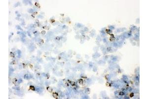 IHC testing of frozen rat lung with SFTPA1/2 antibody. (SFTPA1/ 2 抗体)