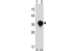 Western Blotting (WB) image for anti-Transaldolase 1 (TALDO1) antibody (ABIN3002744) (TALDO1 抗体)