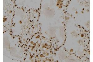 ABIN6277485 at 1/100 staining Human lung tissue by IHC-P. (RAD23A 抗体  (C-Term))
