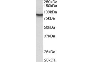 Staining of Mouse Brain lysate usng DLG4 / PSD95 antibody at 0. (DLG4 抗体  (Internal Region))