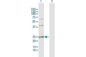 Western Blot analysis of ARL4D expression in transfected 293T cell line by ARL4D MaxPab polyclonal antibody. (ARL4D 抗体  (AA 1-201))