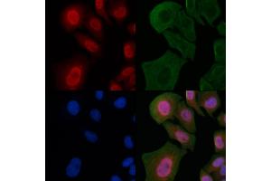 ABIN6263312 and ABIN6266806 staining Hela cells by IF/ICC. (Meningioma 1 抗体  (Internal Region))
