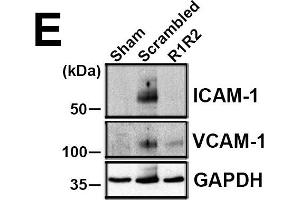 R1R2 decreases inflammatory cell accumulation and VCAM-1 and ICAM-1 levels. (ICAM1 抗体)
