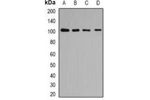 Western blot analysis of p102 expression in Hela (A), HepG2 (B), mouse liver (C), mouse kidney (D) whole cell lysates. (COPB2 抗体)