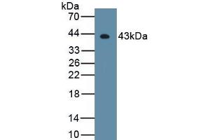 Detection of Recombinant HDAC11, Mouse using Polyclonal Antibody to Histone Deacetylase 11 (HDAC11) (HDAC11 抗体  (AA 1-347))