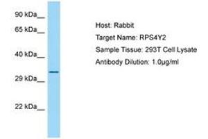 Image no. 1 for anti-Ribosomal Protein S4, Y-Linked 2 (RPS4Y2) (AA 166-215) antibody (ABIN6749893) (RPS4Y2 抗体  (AA 166-215))