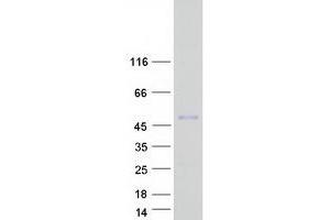 Western Blotting (WB) image for Myocyte Enhancer Factor 2B (MEF2B) protein (Myc-DYKDDDDK Tag) (ABIN2725758)
