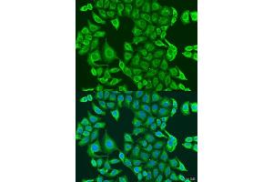 Immunofluorescence analysis of U2OS cells using PDK2 antibody (ABIN1681304, ABIN3018413, ABIN3018414 and ABIN6220461) at dilution of 1:100. (PDK2 抗体  (AA 128-407))