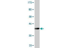 Western Blot detection against Immunogen (37. (RASA3 抗体  (AA 725-834))