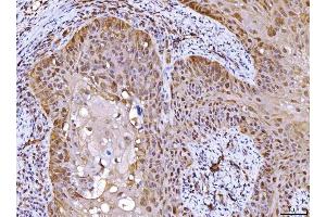 IHC analysis of AHA1/AHSA1 using anti-AHA1/AHSA1 antibody (ABIN7600708).