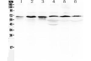 Western blot analysis of TRAF5 using anti-TRAF5 antibody . (TRAF5 抗体  (AA 277-557))