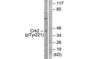 Western blot analysis of extracts from COS7 cells, using CrkII (Phospho-Tyr221) Antibody. (Crk 抗体  (pTyr221))