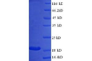 SDS-PAGE (SDS) image for Beta Lactoglobulin (LGB) (full length) protein (ABIN7479571) (Beta Lactoglobulin (LGB) (full length) 蛋白)