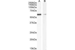 ABIN6391377 (1µg/ml) staining of HEK293 (A) and HeLa (B) cell lysate (35µg protein in RIPA buffer). (IDE 抗体  (AA 10-14))
