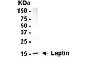Western Blotting (WB) image for anti-Leptin (LEP) (full length) antibody (ABIN2467855) (Leptin 抗体  (full length))