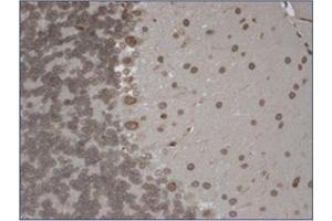 Immunohistochemistry (IHC) image for anti-Transient Receptor Potential Cation Channel, Subfamily M, Member 7 (TRPM7) (AA 1817-1863), (C-Term) antibody (ABIN452417) (TRPM7 抗体  (C-Term))