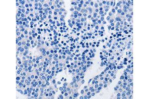 Immunohistochemistry (IHC) image for anti-TNF Receptor-Associated Protein 1 (TRAP1) antibody (ABIN1875197) (TRAP1 抗体)