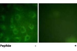 Immunofluorescence analysis of COS-7 cells, using PDGFRB polyclonal antibody . (PDGFRB 抗体)