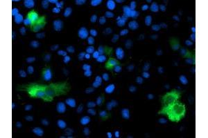 Anti-DPP9 mouse monoclonal antibody (ABIN2455318) immunofluorescent staining of COS7 cells transiently transfected by pCMV6-ENTRY DPP9 (RC224465). (DPP9 抗体)