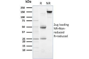 SDS-PAGE Analysis Purified PLK1 Mouse Monoclonal Antibody (AZ44). (PLK1.S 抗体)