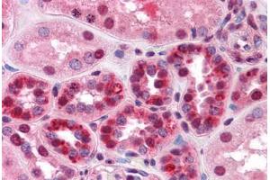 Human Kidney: Formalin-Fixed, Paraffin-Embedded (FFPE) (TARDBP 抗体  (AA 1-261))