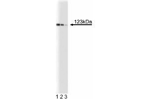 Western blot analysis of DLC-1 on a SK-Hep-1 (human liver adenocarcinoma) lysate. (DLC1 抗体  (AA 47-249))