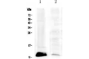 Western blot analysis of Tff1 using anti-Tff1 antibody . (TFF1 抗体  (AA 22-87))