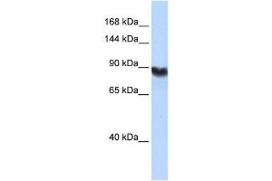 LIG1 antibody used at 1 ug/ml to detect target protein. (LIG1 抗体  (Middle Region))