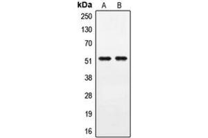 Western blot analysis of PPHLN1 expression in A549 (A), COLO205 (B) whole cell lysates. (PPHLN1 抗体  (Center))