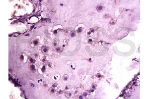 Formalin-fixed and paraffin embedded human placenta tissue labeled with Anti-GLP-1R Polyclonal Antibody, unconjugated (ABIN731333) at 1: 200 followed by incubation with conjugated secondary antibody and DAB staining (GLP1R 抗体  (AA 101-200))