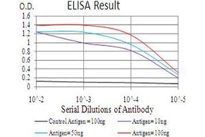 Black line: Control Antigen (100 ng), Purple line: Antigen(10 ng), Blue line: Antigen (50 ng), Red line: Antigen (100 ng), (CBX4 抗体  (AA 397-514))