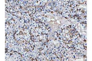 IHC analysis of CD14 using anti-CD14 antibody (ABIN7600531). (CD14 抗体  (AA 20-259))