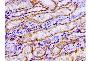 Immunohistochemistry of paraffin-embedded human kidney tissue using ABIN7143021 at dilution of 1:100 (ACO2 抗体  (AA 452-676))