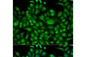 Immunofluorescence analysis of U2OS cells using HSPA1L Polyclonal Antibody (HSPA1L 抗体)