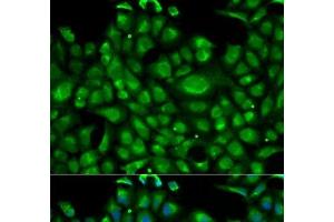 Immunofluorescence analysis of U2OS cells using HSPA1L Polyclonal Antibody
