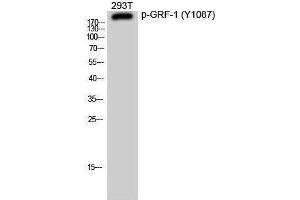 Western Blotting (WB) image for anti-Glucocorticoid Receptor DNA Binding Factor 1 (GRLF1) (pTyr1087) antibody (ABIN3182020) (GRLF1 抗体  (pTyr1087))