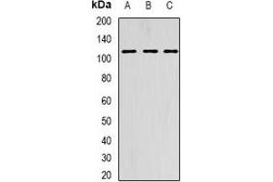 Western blot analysis of AARS2 expression in HepG2 (A), SKOV3 (B), MCF7 (C) whole cell lysates. (AARS2 抗体)