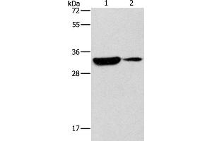 Western Blot analysis of Mouse heart and brain tissue using DSCR1 Polyclonal Antibody at dilution of 1:500 (RCAN1 抗体)