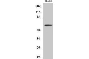 Western Blotting (WB) image for anti-Interleukin 20 Receptor alpha (IL20RA) (Internal Region) antibody (ABIN3185168)