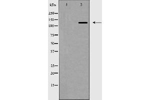 Western blot analysis of ZEB2 expression in HepG2 cell lysate,The lane on the left is treated with the antigen-specific peptide. (ZEB2 抗体  (N-Term))
