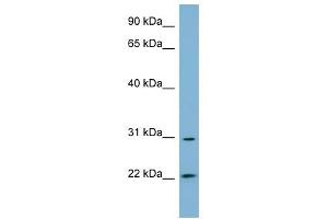 HSD17B14 antibody used at 1 ug/ml to detect target protein. (HSD17B14 抗体)