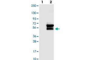 Western blot analysis of Lane 1: Negative control (vector only transfected HEK293T lysate). (OSBPL2 抗体)