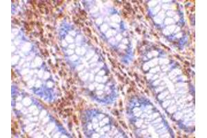 Immunohistochemistry of HTRA2 in human colon tissue with HTRA2 polyclonal antibody  at 10 ug/mL . (HTRA2 抗体  (C-Term))